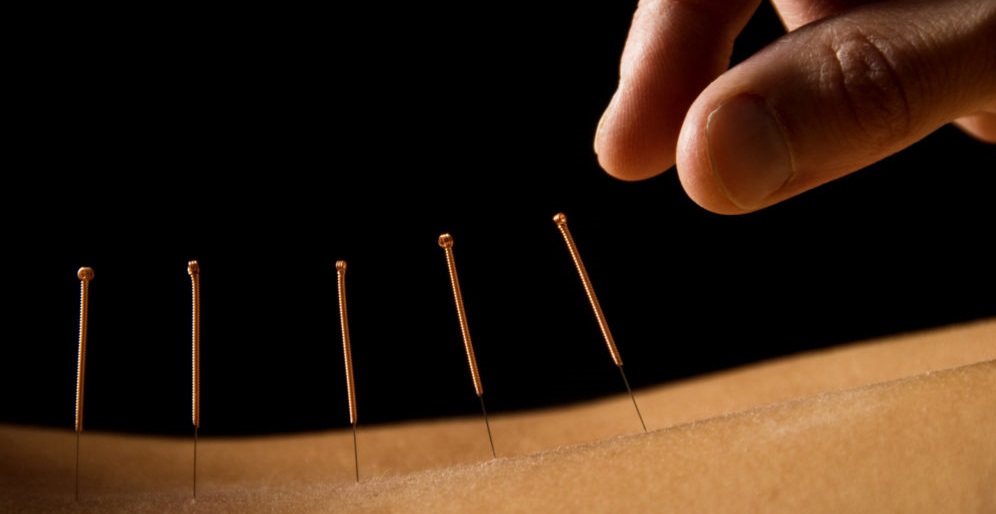 needles on the curve of the back