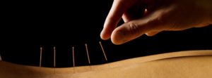 correct placement of acupuncture needles is healing in many ways