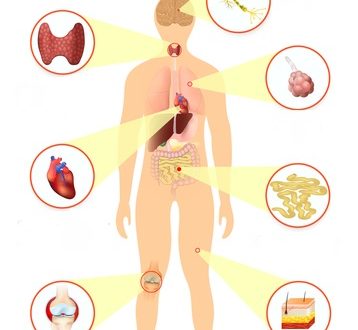How acupuncture helps manage chronic conditions