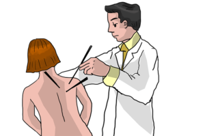 cartoon of doctor using chopstick for acupuncture
